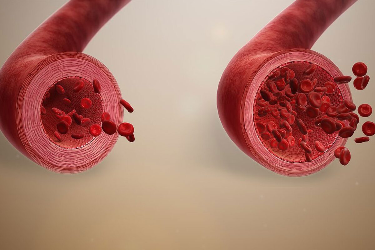 Citrulline, lưu thông máu, HFI, Học viện HFI, HT Fitness