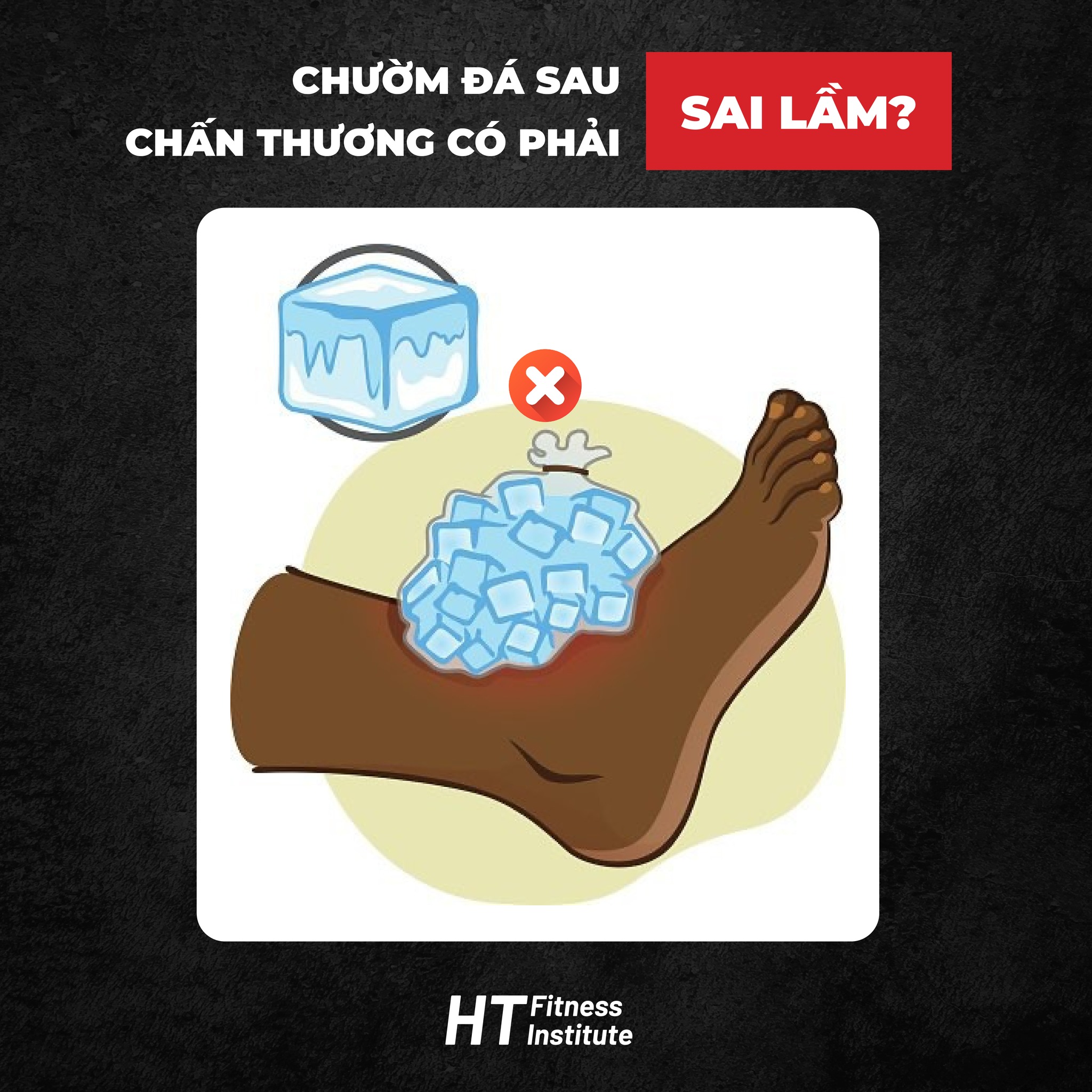 chườm đá, chườm lạnh, HFI, HT Fitness, Học viện HFI