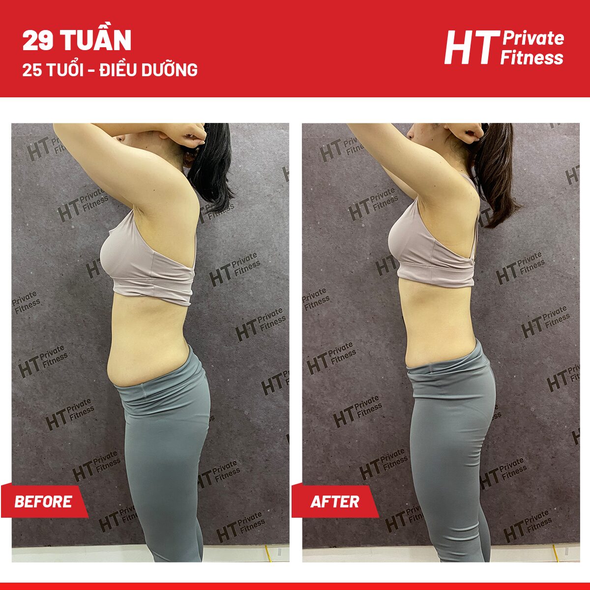 Một hội viên tại HT Private Fitness được HFI cùng đội ngũ HLV hỗ trợ xử lý thành công bụng dưới to