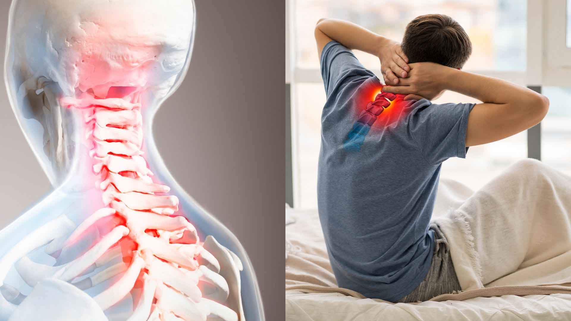 Nếu được nhìn nhận không đúng cách thì thoái hóa đốt sống cổ có thể chuyển sang những tình trạng nặng hơn